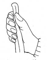 6 fingered hand of the figure of Pier E of House A. 