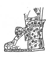 6 toed foot on the North Door Panel of the Temple of the Sun.