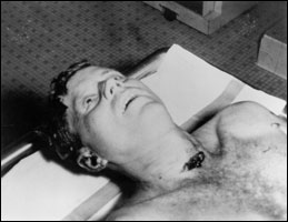Kennedy autopsy photo. 